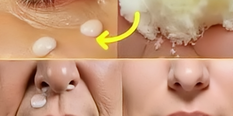 Apply This Mask – Eliminate Wrinkles On Your Face And Make You Look Younger Than Your Age